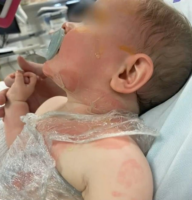 The nine-month-old baby (pictured) was attacked in a Brisbane park on Tuesday.