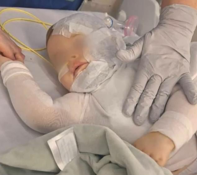 The nine-month-old boy (pictured) was rushed to Queensland Children's Hospital where he continues to recover following emergency surgery.