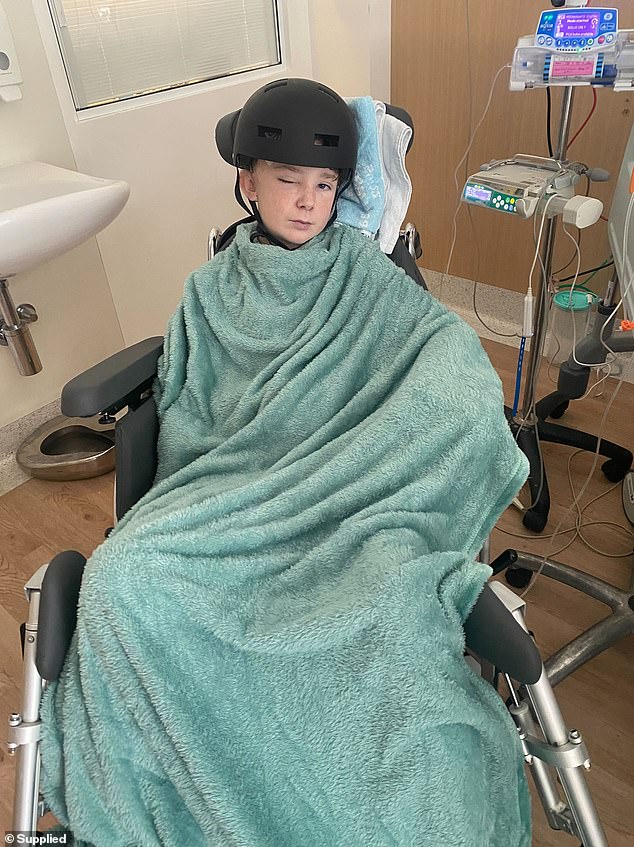 The teenager faces a long road to recovery and has to wear a helmet to protect the section 