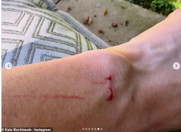 The actress showed her millions of followers a piece of her bloody skin that had apparently been scratched by the cat.