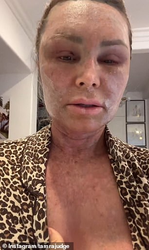 1725397563 170 RHOCs Tamra Judge 57 reveals the pain caused by her