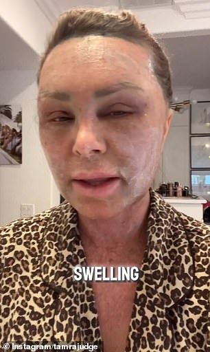 1725397563 618 RHOCs Tamra Judge 57 reveals the pain caused by her