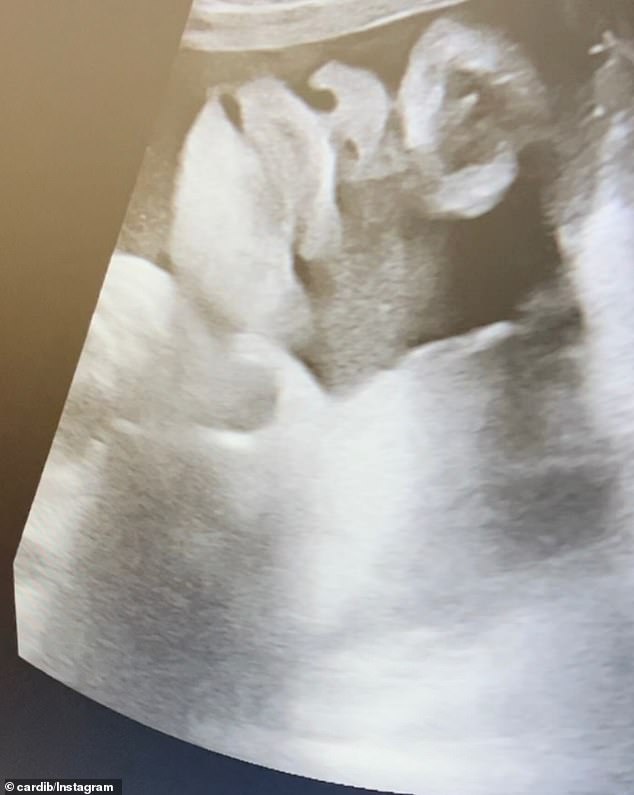 The Bronx-born singer recently shared a photo of an ultrasound on Instagram.