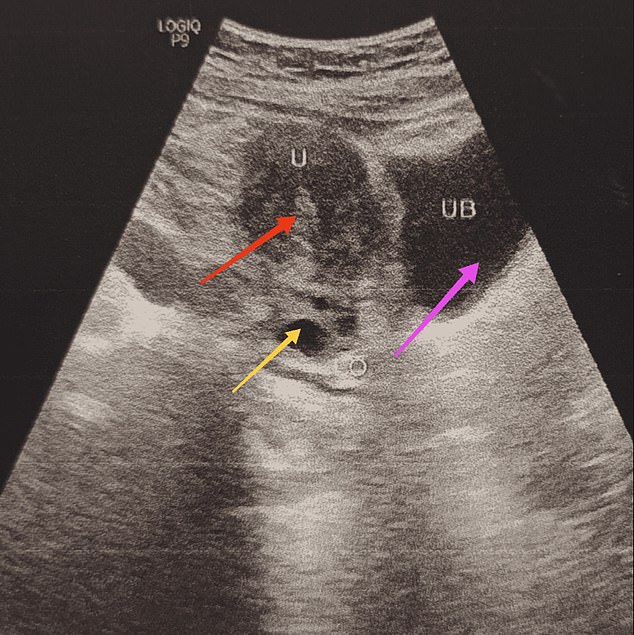 Although the woman's genitalia appeared male, scans showed that her female reproductive organs were intact. Image: Springer Nature