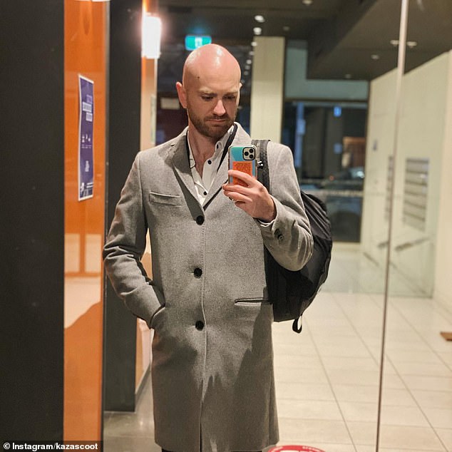 The aspiring actor said he had been forced to shave his head over the past few years as his hair had become unbearably thin on top, despite his young age.