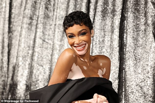 In 2016, Harlow made history by becoming the first model with vitiligo to walk the Victoria's Secret Fashion Show.