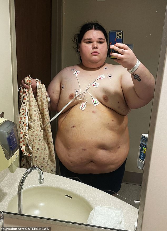 Joshua Hart, who weighs 427 pounds, was constantly mistaken for a woman due to the excess fat around his chest, which gave him the appearance of breasts.