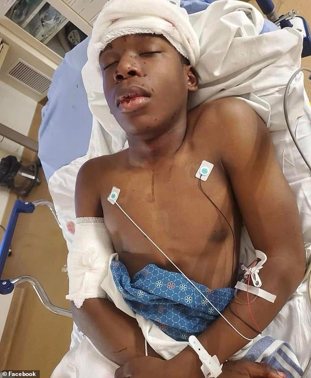 Ralph Yarl, now 17, was shot by Lester on April 13, 2023 after he headed to the wrong address when he went to pick up his younger twin brothers from his friend's house in Kansas City, Missouri (pictured: Yarl in hospital after the shooting)