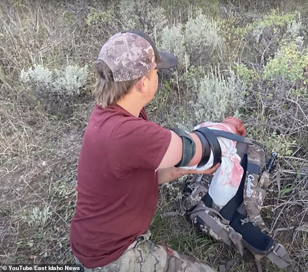 Hill, pictured with his injured arm after the attack, said the bear 