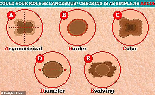 Annual full-body skin checks are recommended, but people can perform regular checks at home. When performing the exam, people should be aware of the basics of skin cancer.