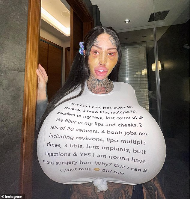 The star documents her extreme body modifications for thousands of fans on social media and OnlyFans.