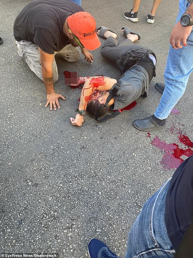 Thousands of people, both Hezbollah members and civilians, were injured.