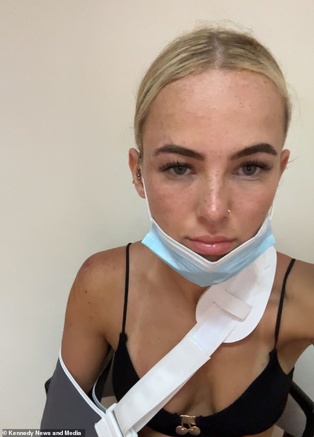 Maddy shared a video of the severity of her injuries as a warning to other tourists