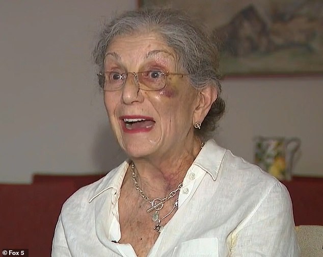 The 81-year-old woman was covered in bruises from numerous injuries and suffered a concussion.