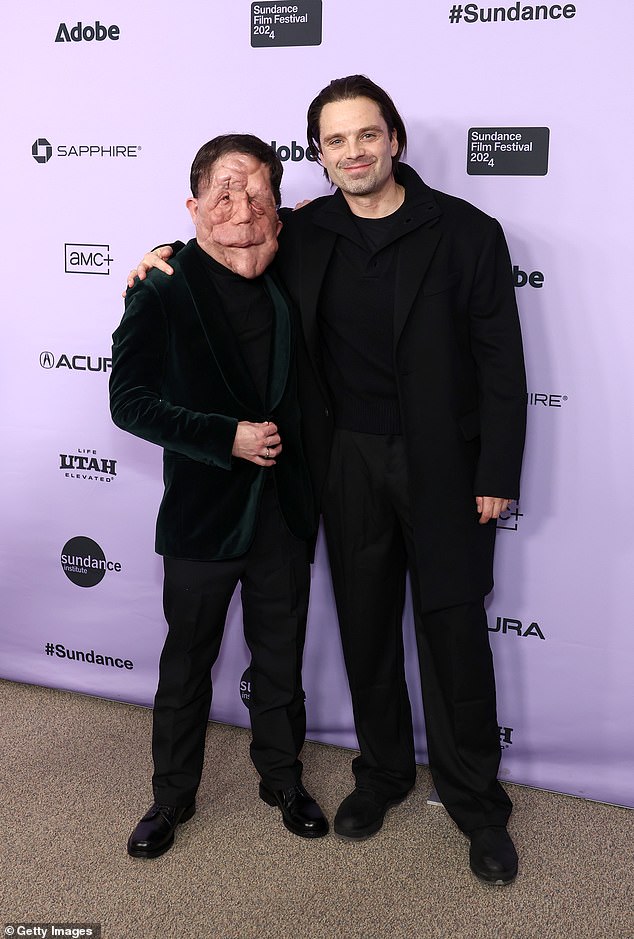 At Sundance, Pearson revealed that he encouraged Stan to go out in public with his prosthetics to get a sense of what it's like for a person to live with a disfigurement; they're seen in January.