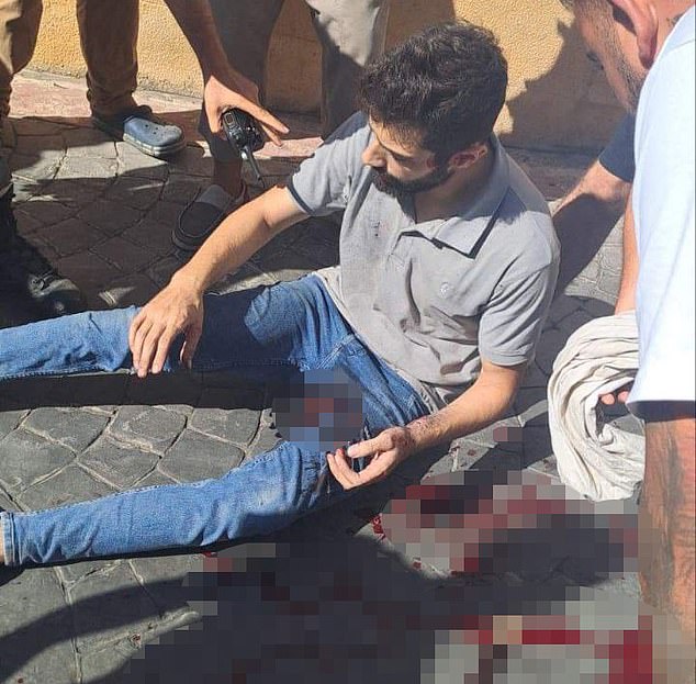 On Tuesday, pagers used by Hezbollah members for vital communications exploded, injuring thousands of people. On Wednesday, radios and walkie-talkies also exploded, like the one pictured in the hand of the man standing next to the victim.