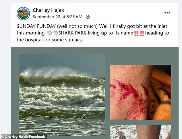 Hajek made a Facebook post documenting the incident before driving to the hospital, demonstrating his relaxed demeanor.