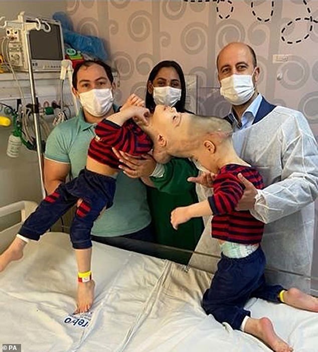 Dr. Jeelani had previously performed surgery to separate Bernardo and Arthur Lima, who were born with fused brains. The twins underwent several operations in Rio de Janeiro, under Dr. Jeelani's direction. Pictured: The twins before the procedure with surgeon Dr. Noor ul Owase Jeelani (right) and their parents Adriely and Antonia Lima (left)