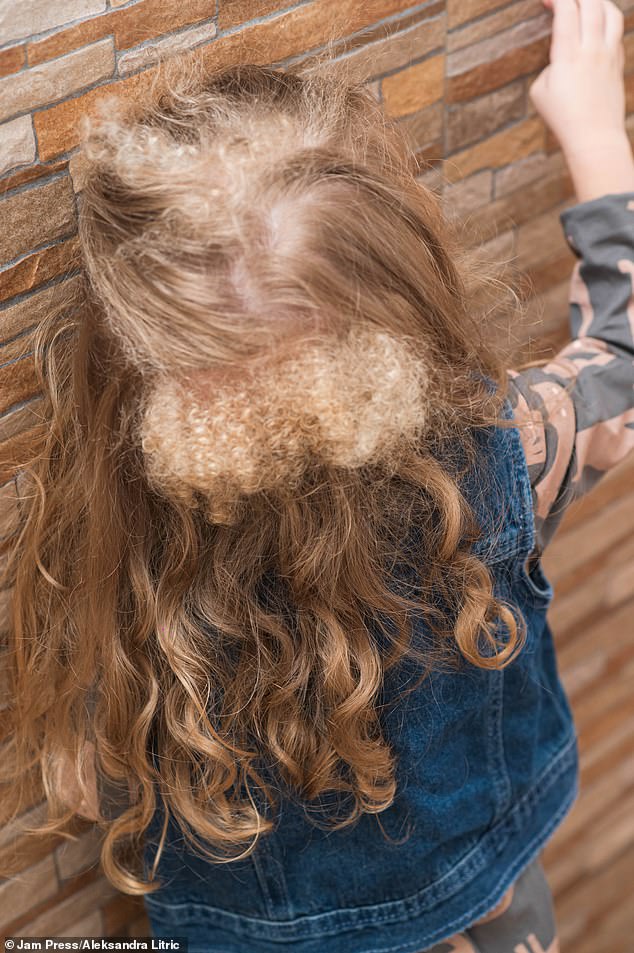 The tourism technician shared clips of her daughter's locks on TikTok to help raise awareness, with one video racking up 1.4 million views and more than 32,000 likes.