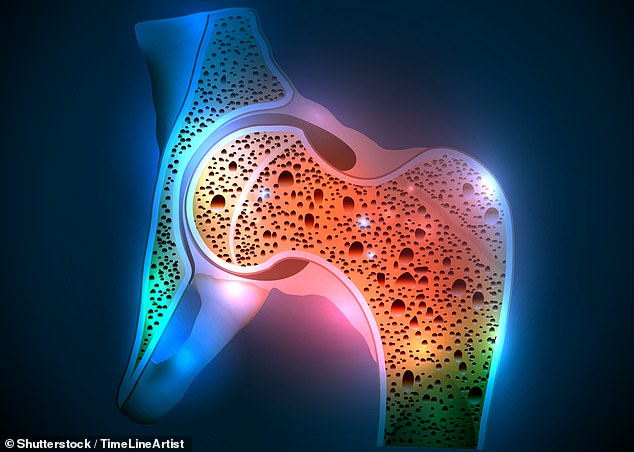 According to NICE, more than two million women in England and Wales suffer from osteoporosis. The disease, which develops slowly over several years, causes weak bones, which increases the likelihood of fractures, according to the NHS.