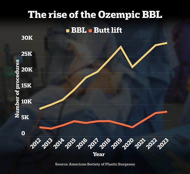 BBLs hit a record high in 2023, while butt lift surgeries also appear to be on the rise