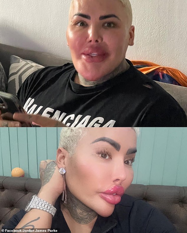 Parke is a fan of Kim Kardashian and has spent more than £130,000 on cosmetic surgery.