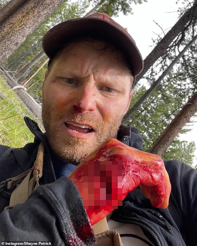 Photographer Shayne Patrick Burke, 35, from Massachusetts, nearly bled to death after being attacked by a mother bear in Grand Teton National Park earlier this year.