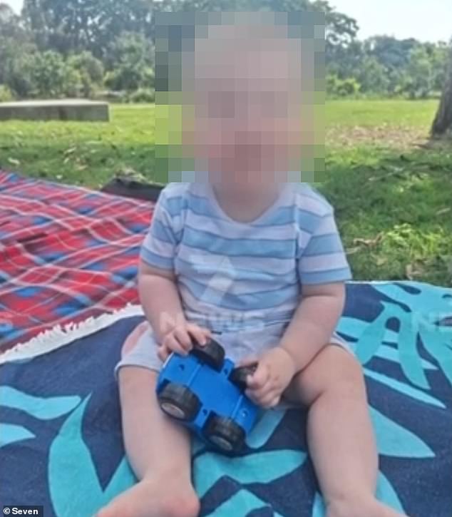 The baby suffered life-threatening burns to his face, upper body and arms and has undergone four operations at Queensland Children's Hospital.