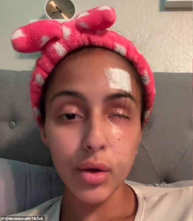 Doctors sewed her eyelid back together and she learned she was permanently blind in her right eye.