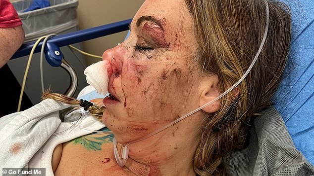 Lindsey Gonzalez, 40, suffered facial damage, including a broken jaw and a broken nose.