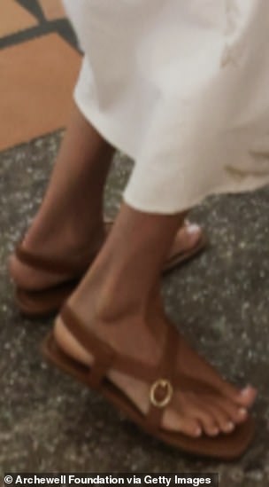 However, more recently, the Duchess has been wearing open-toe shoes, leaving her feet exposed.