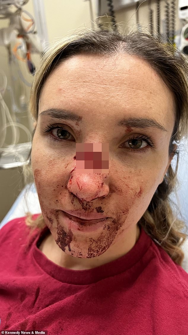 Korinne, pictured, suffered a serious injury after her dog Niko lunged at her face, breaking her nose and tearing off a piece of her skin.