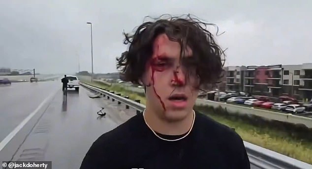 The YouTuber's friend, Michael David, who was sitting in the passenger seat, had a bloody face and had to be taken to the hospital (photo taken from the live broadcast).