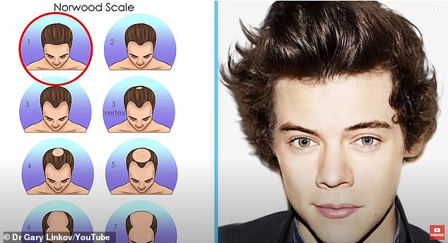 The shot above from Dr. Linkov's YouTube video shows Harry at age 16 in 2010. The plastic surgeon said the singer showed no signs of baldness.