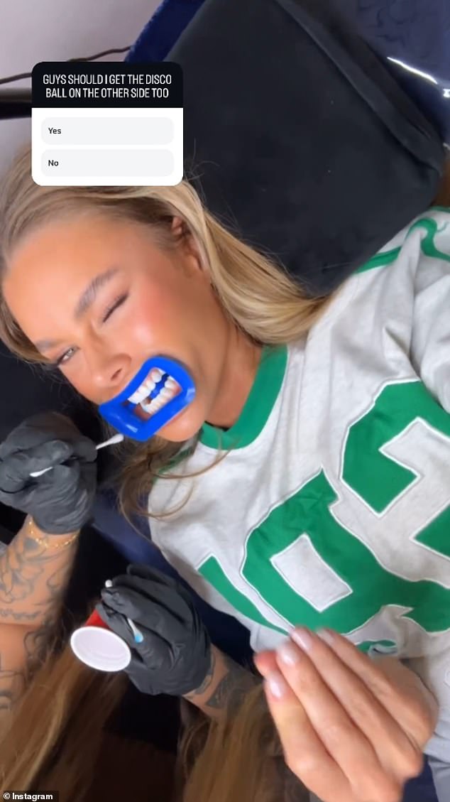 The reality TV star then shared a video showing her 'dental gem artist' painting a blue substance on her teeth to set the gem.