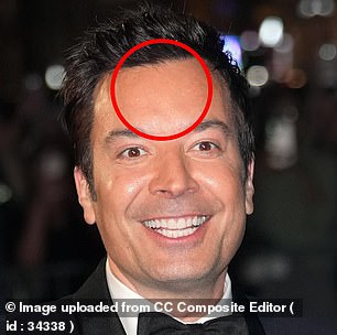 Fallon, photographed in September 2024 at age 50, has a line-free forehead that cosmetic dermatologists say suggests consistent doses of Botox every few months over a long period of time.