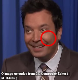 Fallon, pictured in 2024, has chubby cheeks that experts say suggest the use of filler to maintain facial volume.