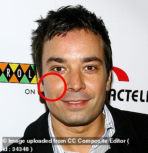 Fallon, photographed in 2007 at age 39, appears to have begun to lose some volume in his face, as is a normal part of aging.