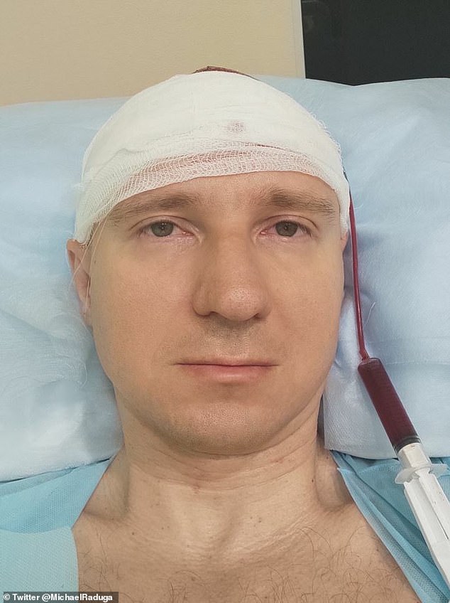 Raduga, 40, had an electrode implanted in his brain to 'control his dreams'