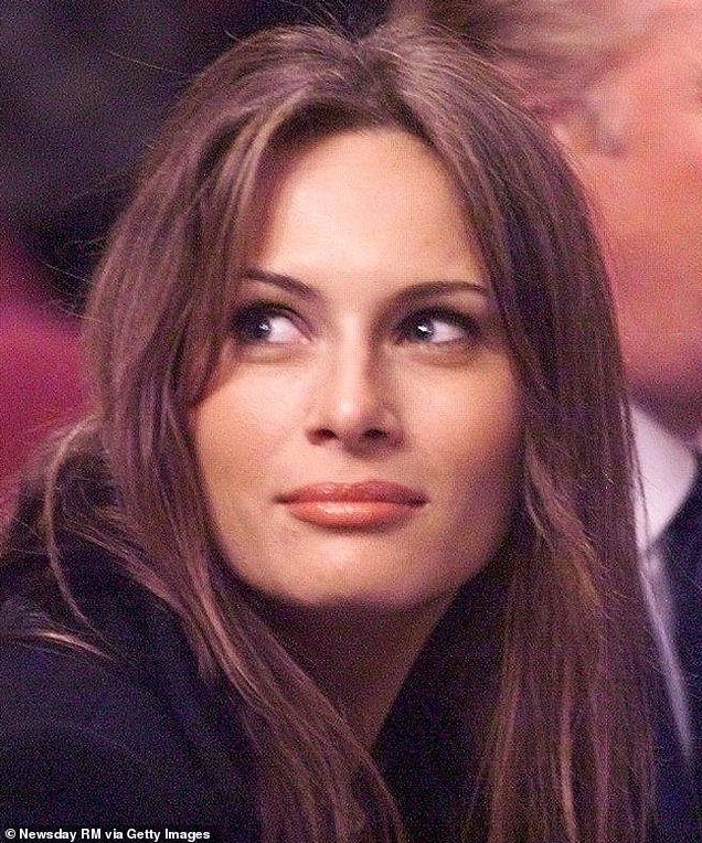 An image of her at age 29, photographed in 1999, appears to show that she has fuller lips. Dr. Linkov suggests that because the filler was not approved by the FDA until 2003, it may have used collagen or silicone in microbeads.