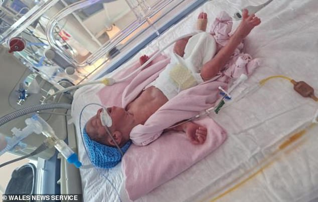 Tesni Griffiths had to undergo an emergency C-section while abroad and baby Aras was born on September 27, weighing just 2lb 2oz.