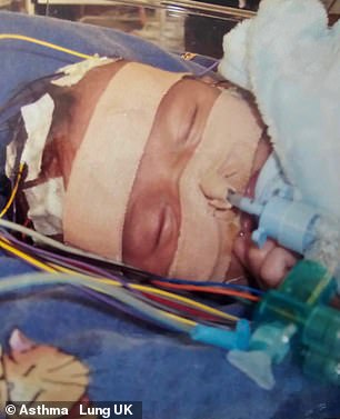 Despite a miraculous recovery as a baby (here), Spike was left with permanent brain damage