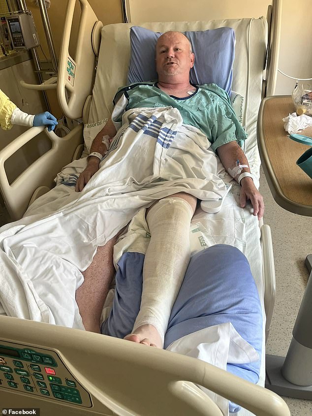 Similar incidents have also been seen in the US and Canada, with Toronto's Tommy Dalton severely burned by a 5-inch table fire pit purchased from Colsen 