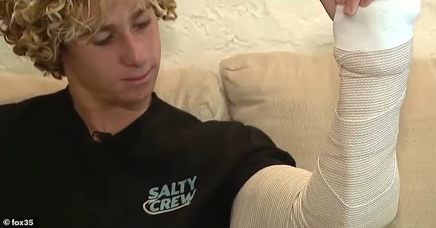 Fortunately, there was no major damage and he escaped with 30 stitches and was sent home after two days to recover in a cast on his arm for the next month.