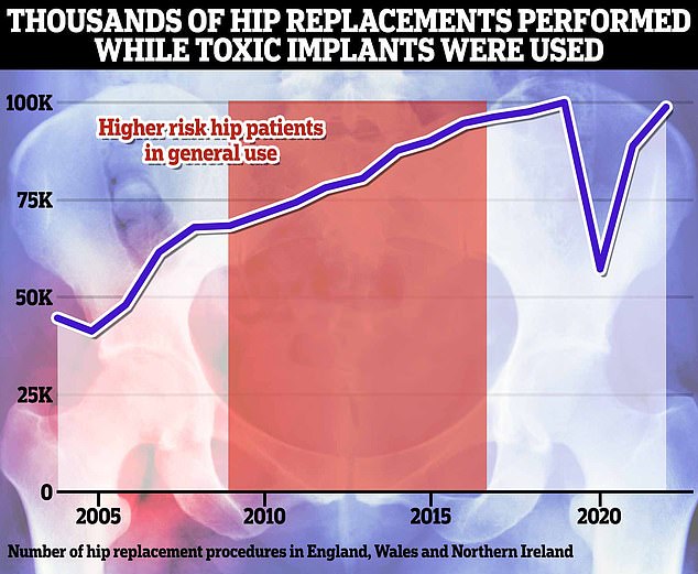 1729238443 153 Poisoned by hip replacement Thousands feared could be at risk