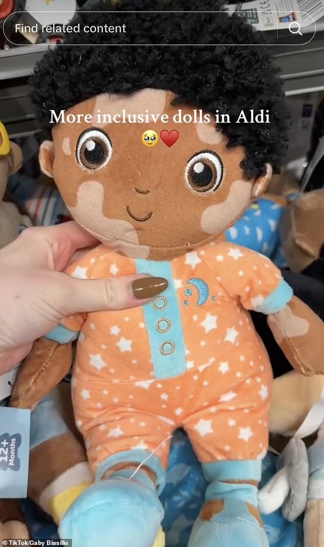 Gaby Biasillo, a 25-year-old mother, said it is the first time she has seen a doll with a birthmark.