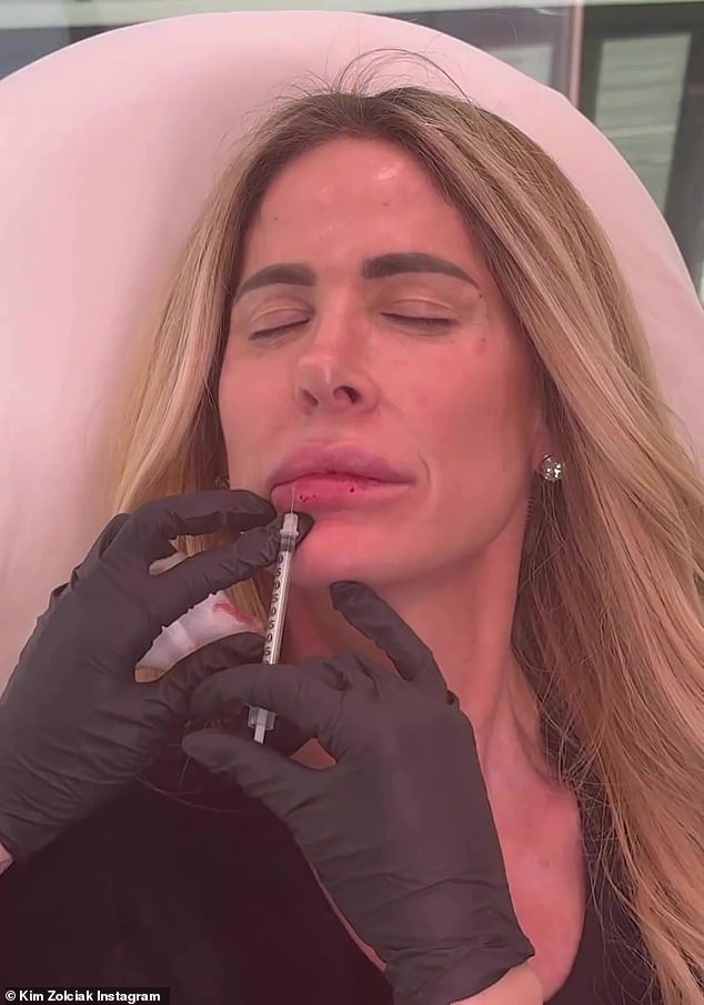 In March, Kim uploaded a video showing her receiving fillers and Botox at a medical spa in Atlanta.