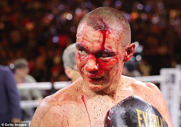 Fans have suggested that Tszyu still hasn't recovered from his bloody loss to Sebastian Fundora.