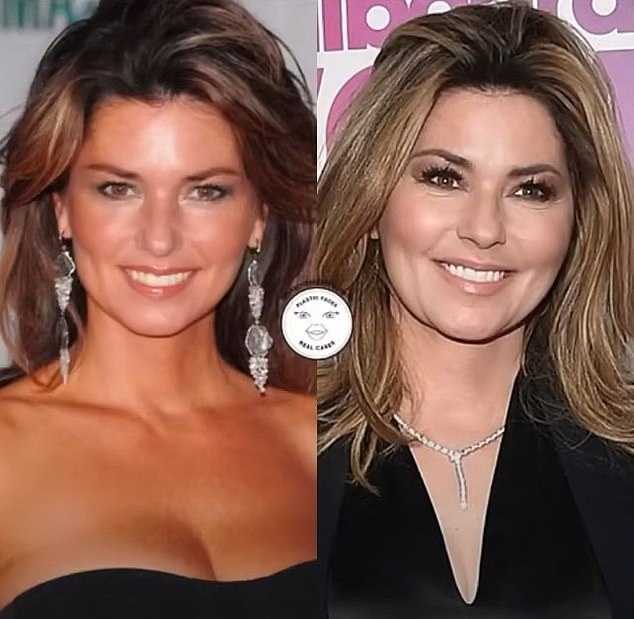 Shania Twain appears on the left at the 42nd CMA Awards in November 2008, and on the right at the Billboard Women in Music event in 2016.