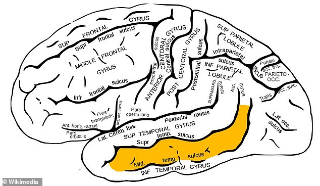 The researchers studied cells from the temporal gyrus, a region found near the base of the brain and is crucial in language and memory.